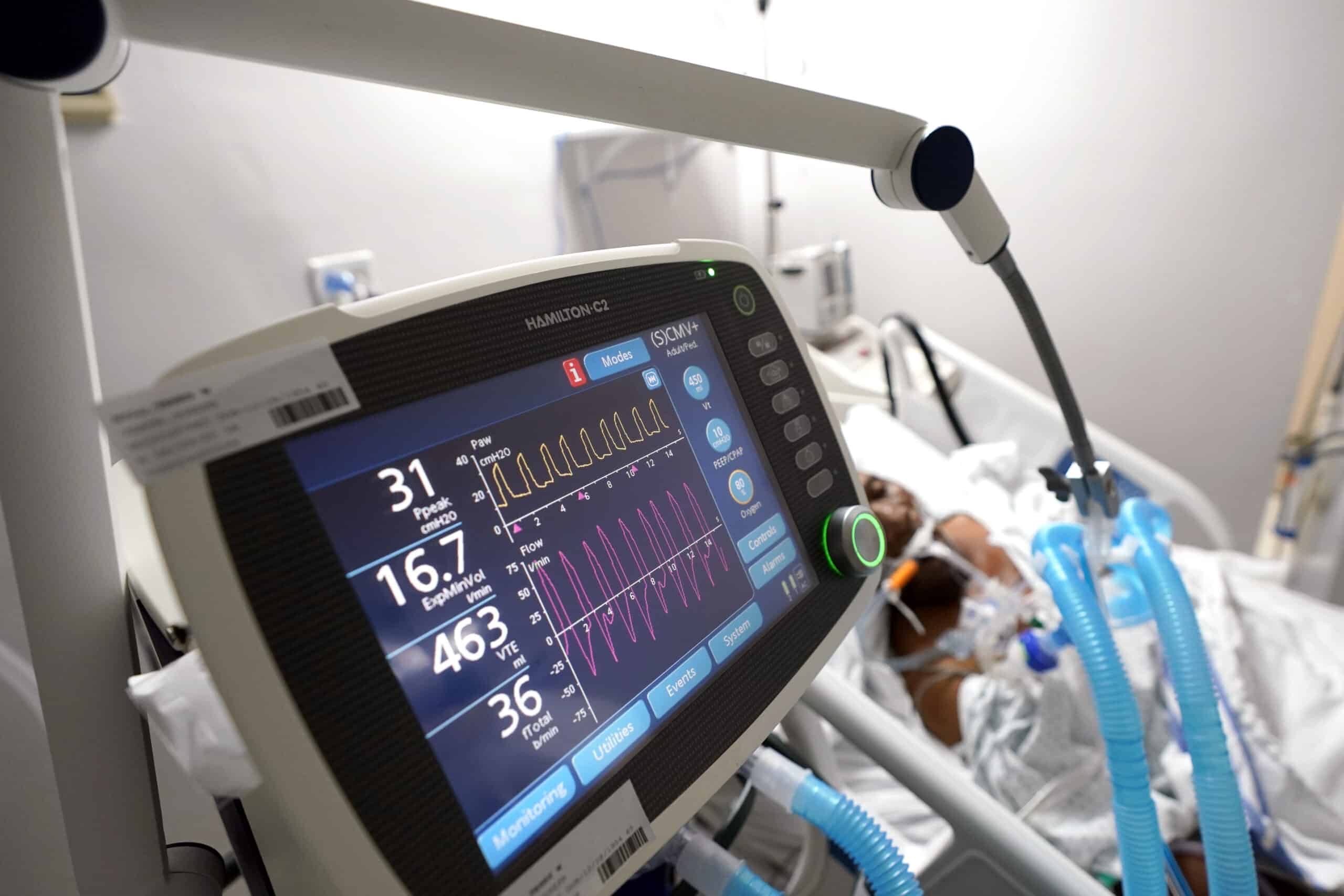 A COVID-19 patient on a ventilator